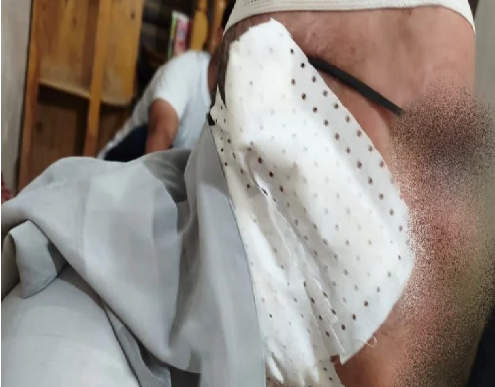 اعتداء خطير على إمام مسجد